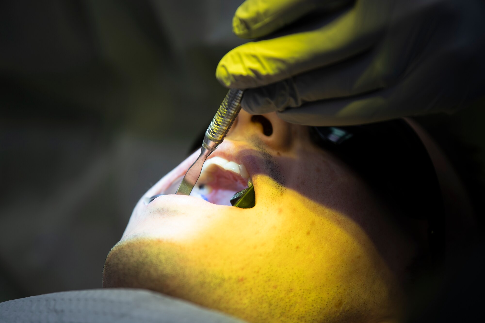 Dentist works on patient