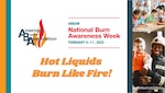 National Burn Awareness Week: Hot liquids can burn like fire