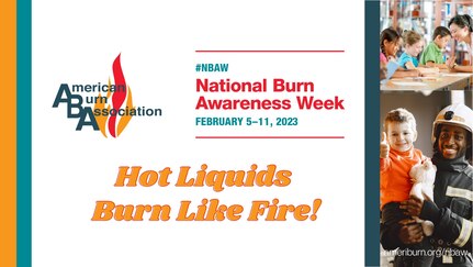 National Burn Awareness Week: Hot liquids can burn like fire