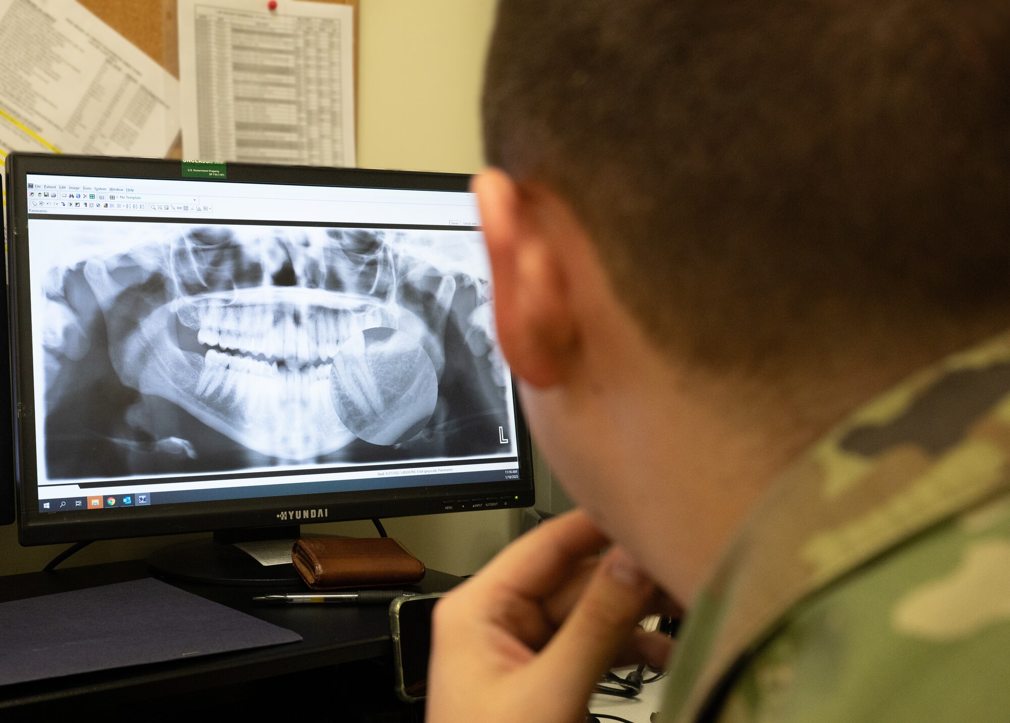 Staff Sgt. Anthony Brockey, 8th Operational Medical Readiness Squadron dental technician, looks at an x-ray at Kunsan Air Base, Republic of Korea, Jan. 18, 2023. Looking at a patient’s x-ray enables doctors to see the state of one’s health without intrusively examining their body. This photo has been altered to remove sensitive information. (U.S. Air Force photo by Staff Sgt. Sadie Colbert)