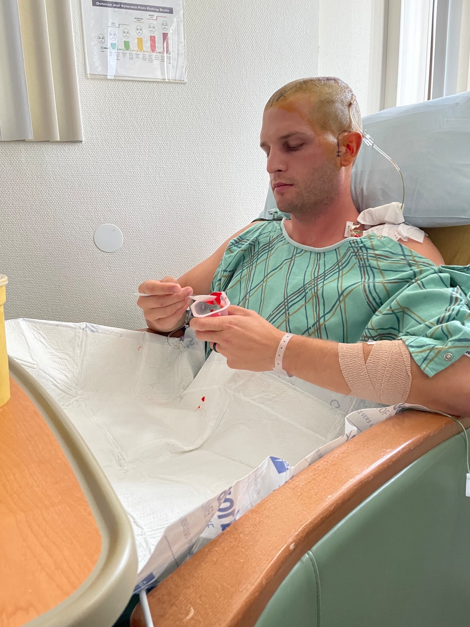 U.S. Air Force Tech Sgt. Paul Vermaire, 86th Operations Support Squadron air traffic controller, recuperates from surgery at Landstuhl Medical Center, Germany, Sept. 2021.