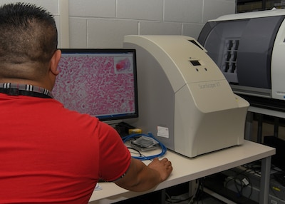A man with his back to the camera looks at a computer monitor. The monitor shows the image of a scanned glass slide. The red of the dye used can be seen with white lines running through the image on the monitor.