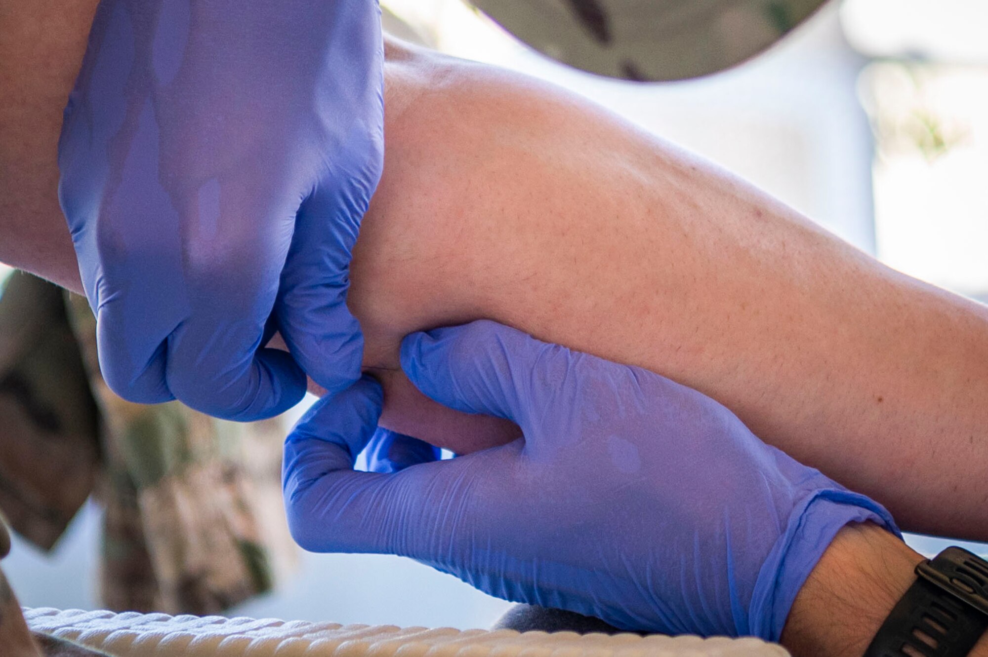 U.S. Air Force Capt. Sean Piccolo, a 386th Expeditionary Medical Squadron physical therapist, performs a dry needling treatment during a health fair at Ali Al Salem Air Base, Kuwait, April 27, 2023.