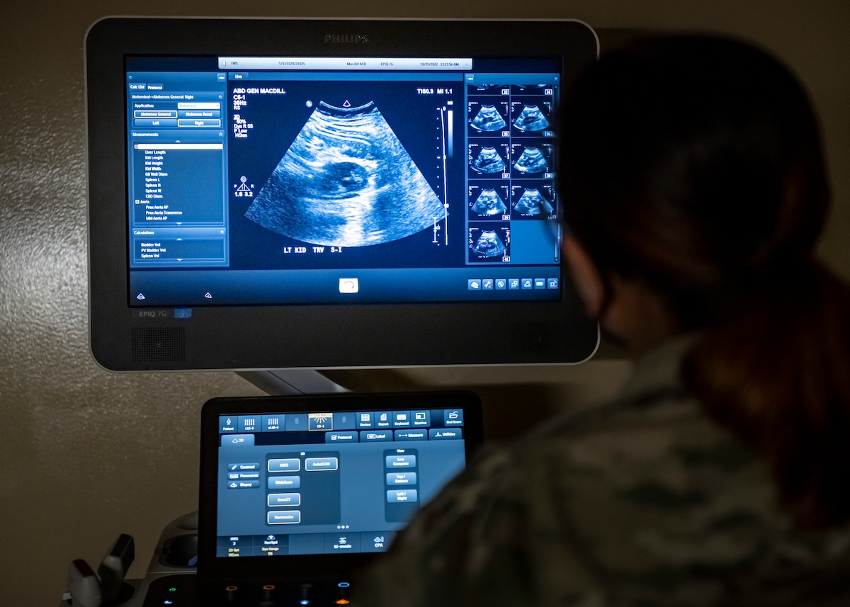 U.S. Air Force Tech. Sgt. Leila Liza Smith, a diagnostic imaging specialist with the 6th Medical Group, practices abdominal ultrasound procedures at MacDill Air Force Base, Florida, Oct. 25, 2022. Smith evaluates the images produced by the ultrasound for abnormalities, such as lumps or nodules on the thyroid gland. (U.S. Air Force photo by Senior Airman Lauren Cobin)
