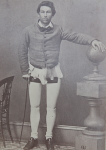 A photograph at the National Museum of Health and Medicine in Silver Spring, Maryland shows an amputee during the Civil War era fitted with prostheses.