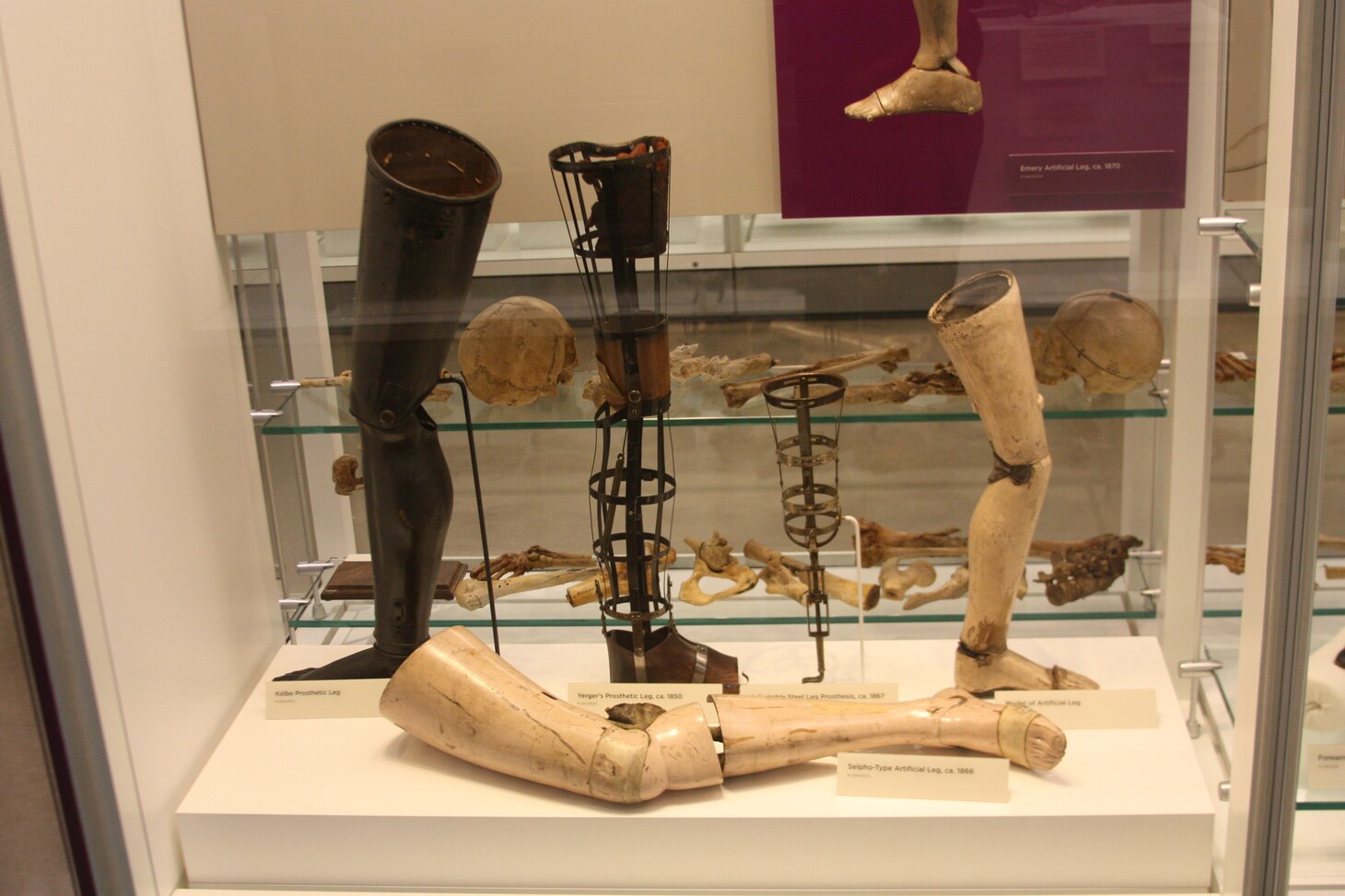 The National Museum of Health and Medicine in Silver Spring, Maryland has more than 25 million objects in its collection, which includes prosthetics used by service members throughout the years.