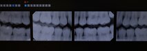 A patient's X-ray is displayed on a monitor in the 5th Medical Group building at Minot Air Force Base, North Dakota, April 27, 2023. Air Force Dental technicians help provide patient care in every procedure. (U.S. Air Force photo by Airman 1st Class Nottingham)