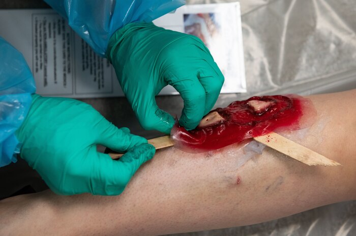 Joint Base Charleston Airmen participate in a medical exercise where they act as patients with simulated wounds. Medical Group staff wear protective hear as they treat the simulated patients.