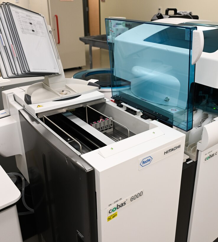 A hemoglobin A1C sample is processing on the chemistry analyzer.