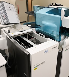 A hemoglobin A1C sample is processing on the chemistry analyzer.