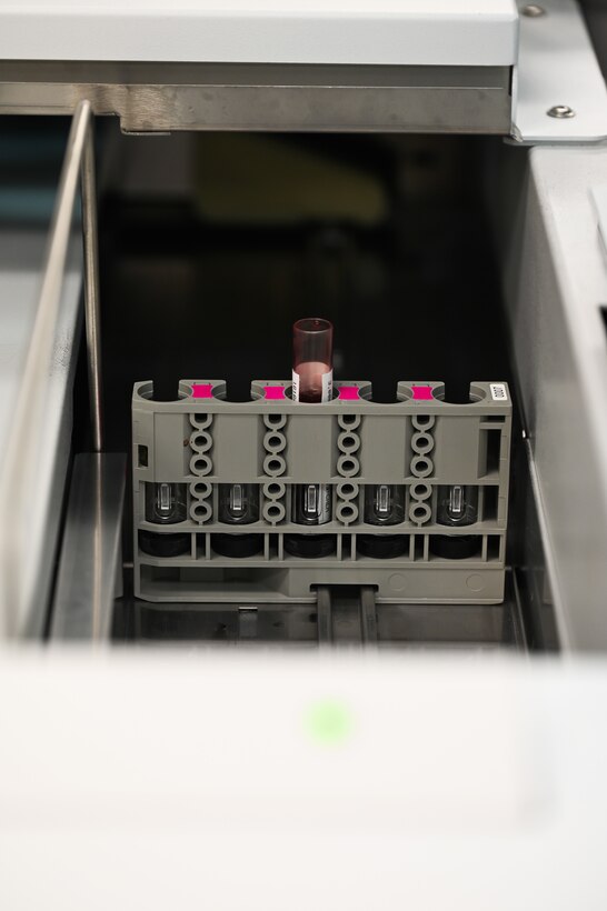 A vial of blood sits in a machine to be analyzed.