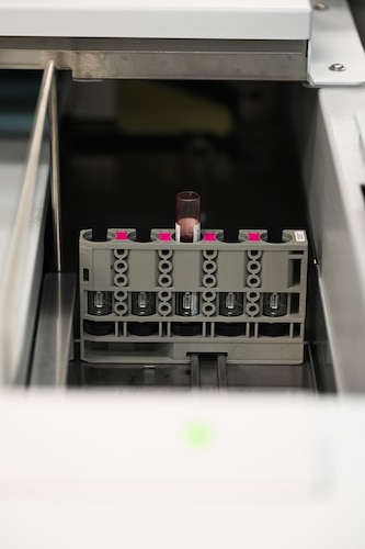 A vial of blood sits in a machine to be analyzed.