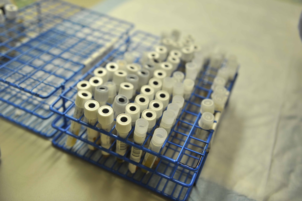 Various small test tubes sit in a small holder.