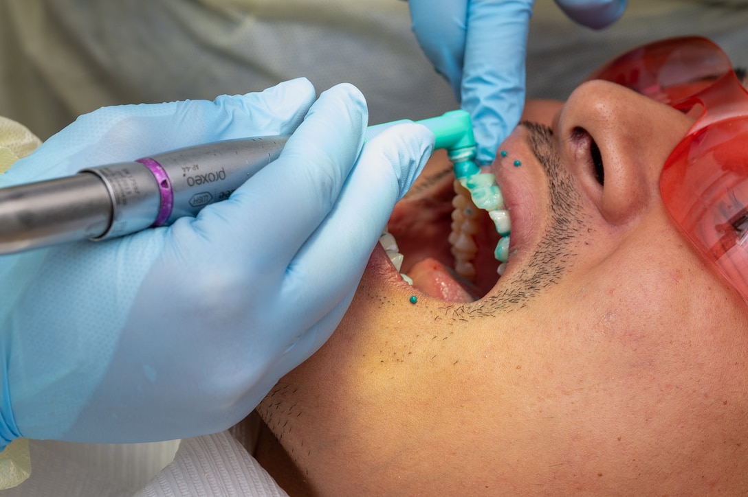 U.S. Air Force Senior Airman Caleb, 1st Maintenance Group analyst, receives a tooth polishing at the 633d Dental Squadron at Joint Base Langley-Eustis, Virginia, April 4, 2024. Polishing removes stains and any remaining tartar from the tooth’s surface. (U.S. Air Force photo by Airman 1st Class Skylar Ellis)