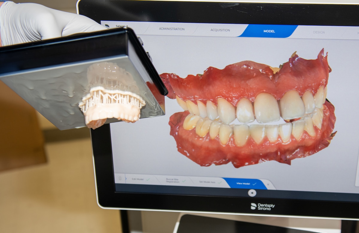 A 3D print of a dentition is shown next to a computer screen with a digital image of a patient's mouth.