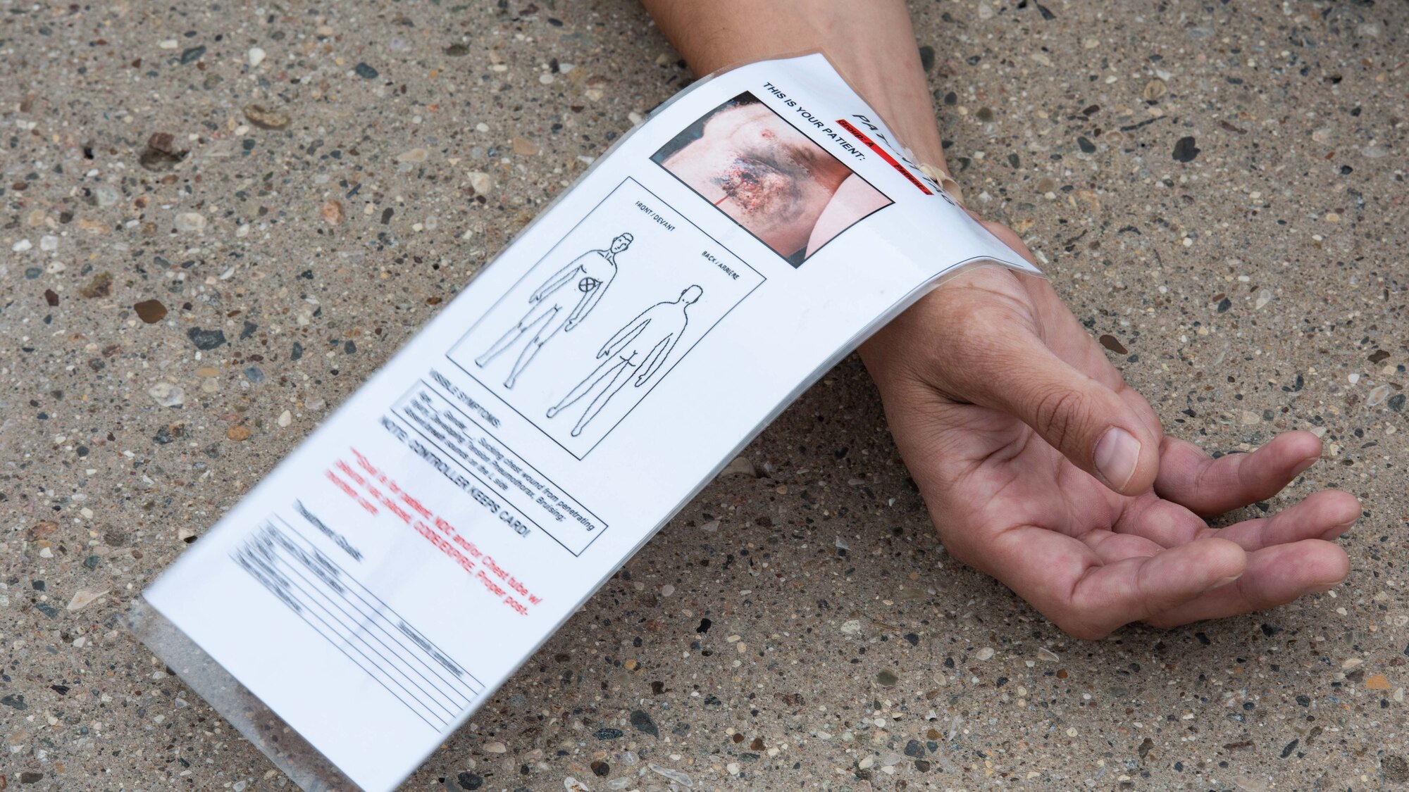 A patient tag is secured to a simulated casualty’s wrist during a major accident response exercise (MARE) at Minot Air Force Base, North Dakota, Aug. 21, 2024. The patient tag provided information for first responders regarding the extent and type of injuries the simulated casualty had sustained. (U.S. Air Force photo by Senior Airman Kyle Wilson)