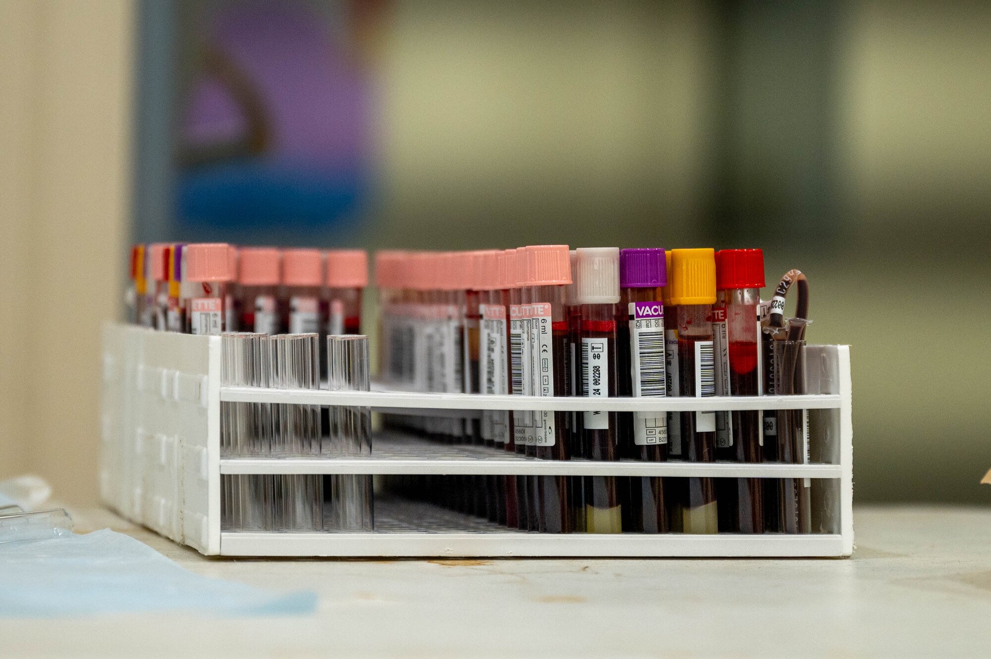 Vials of blood.