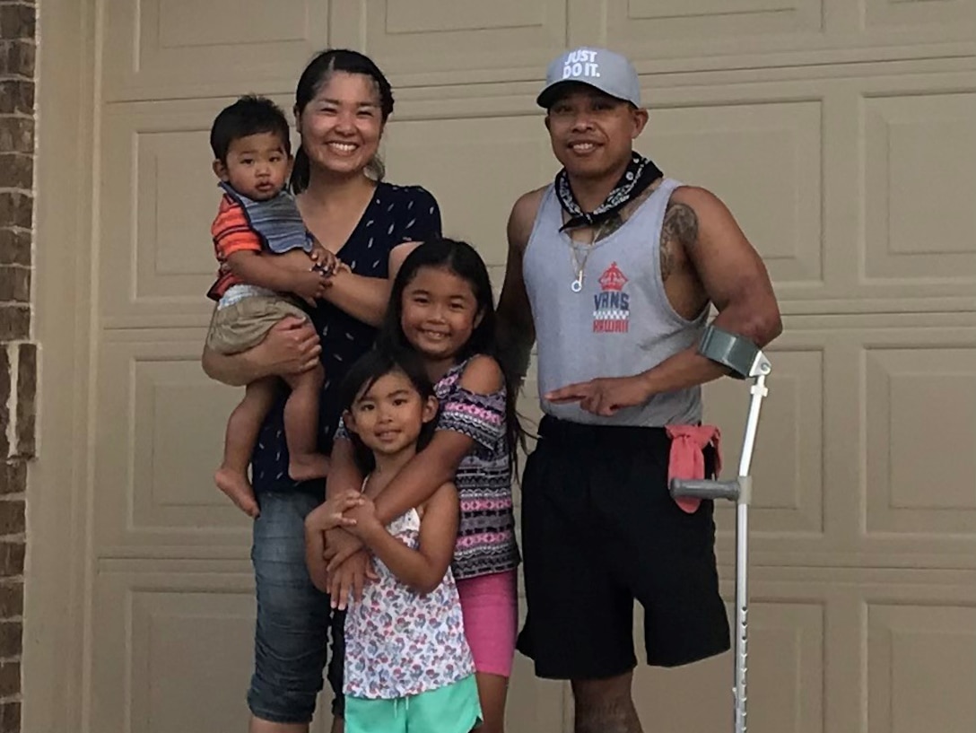 Two months later, this is the first photo of the Calantocs together after the amputation.