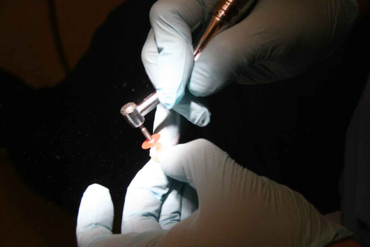 Hands hold a tiny drill against a tooth held in another hand.