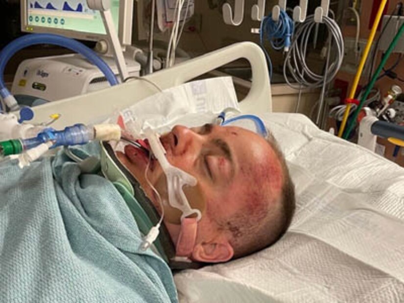 Courtesy Photo | (Photo courtesy Maj. Josh Lindsey) Maj. Josh Lindey in Brooke Army Medical Center right after his accident in January 2023.