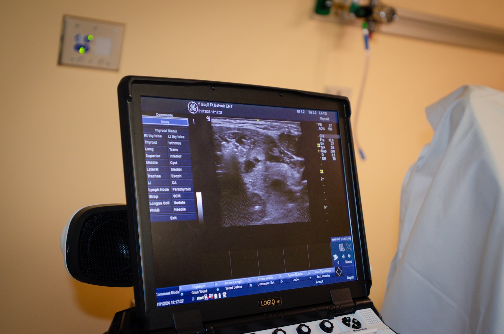 FORT BELVOIR, VA. (January 12, 2024)--
Surgical monitor displays progress of thyroid ablation procedure at the Alexander T. Augusta Military Medical Center January 12, 2024.


(Department of Defense photo by Kyle Harvey)