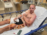 Sgt. 1st Class Jeffrey Peters just after his cycling accident