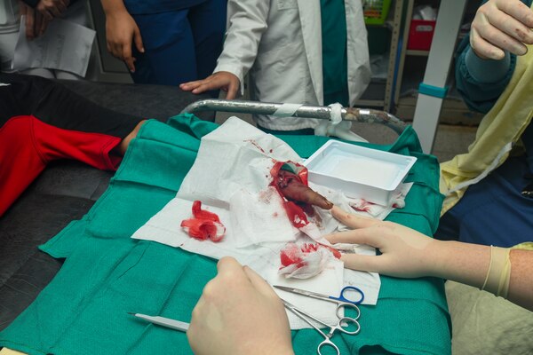 Reynaldo Muñoz, a 19-year-old Honduran resident, shows medical personnel that he can extend his left index finger on his own after an operation in the trauma bay of Hospital Nacional Mario Catarino Rivas mission on Feb. 27, 2024. EMU 10 G conducted its first GHE to enhance expeditionary core skills and knowledge exchange with Honduran healthcare professionals in a limited resource environment, Feb. 17 – March 2, 2024.