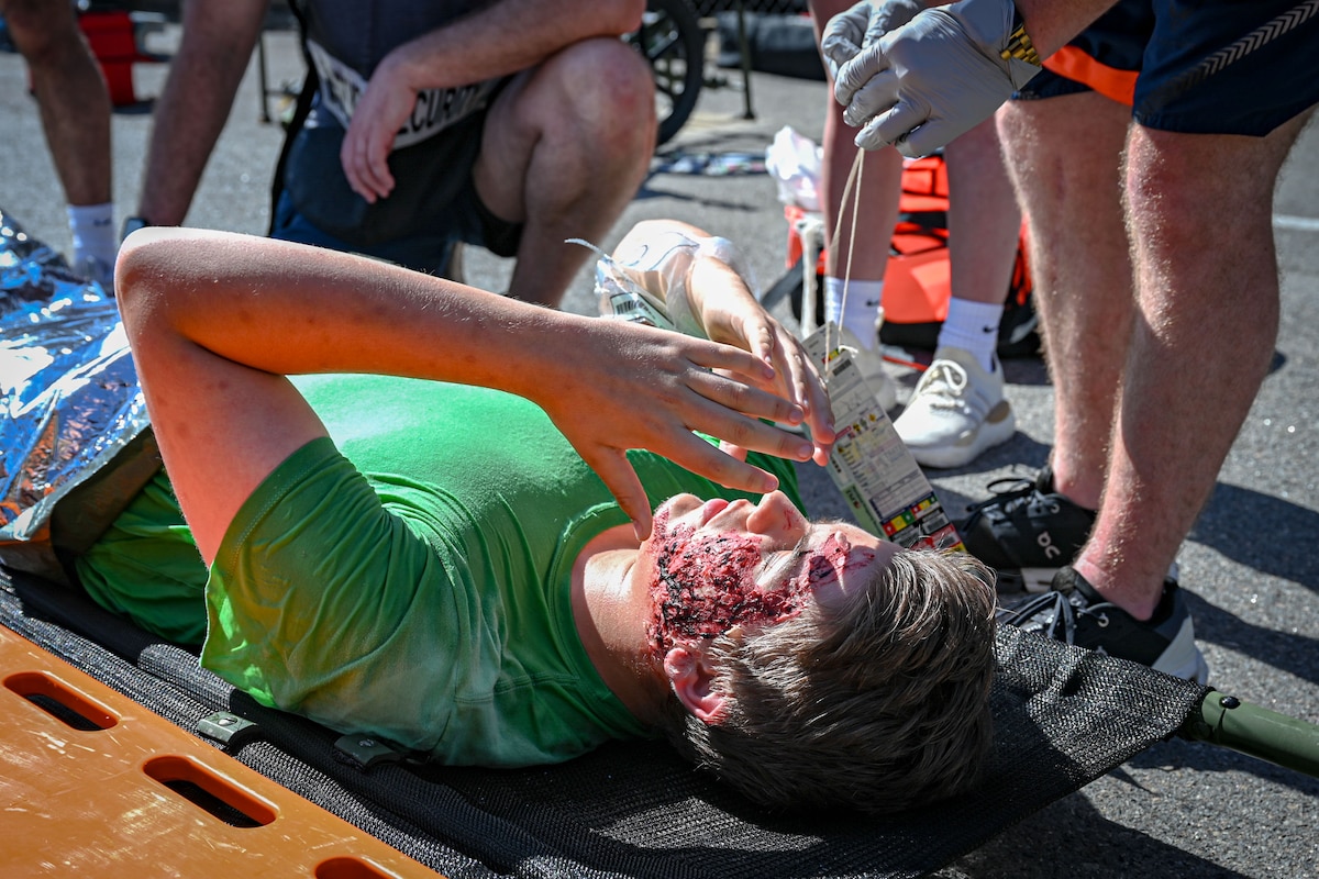 A patient simulates burns on their face while being tended to by medical care.