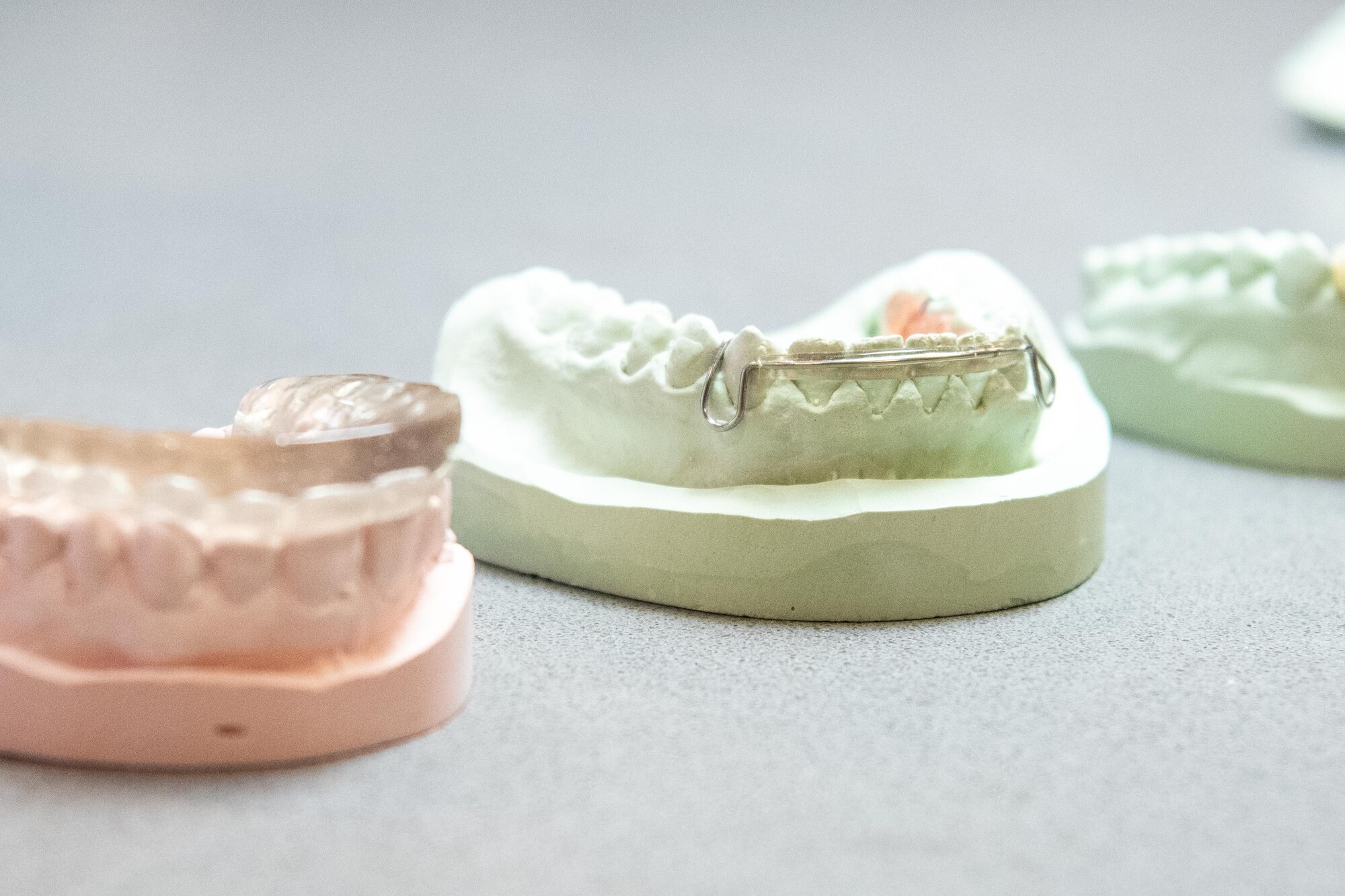 Plaster cast dental molds are displayed during a tour