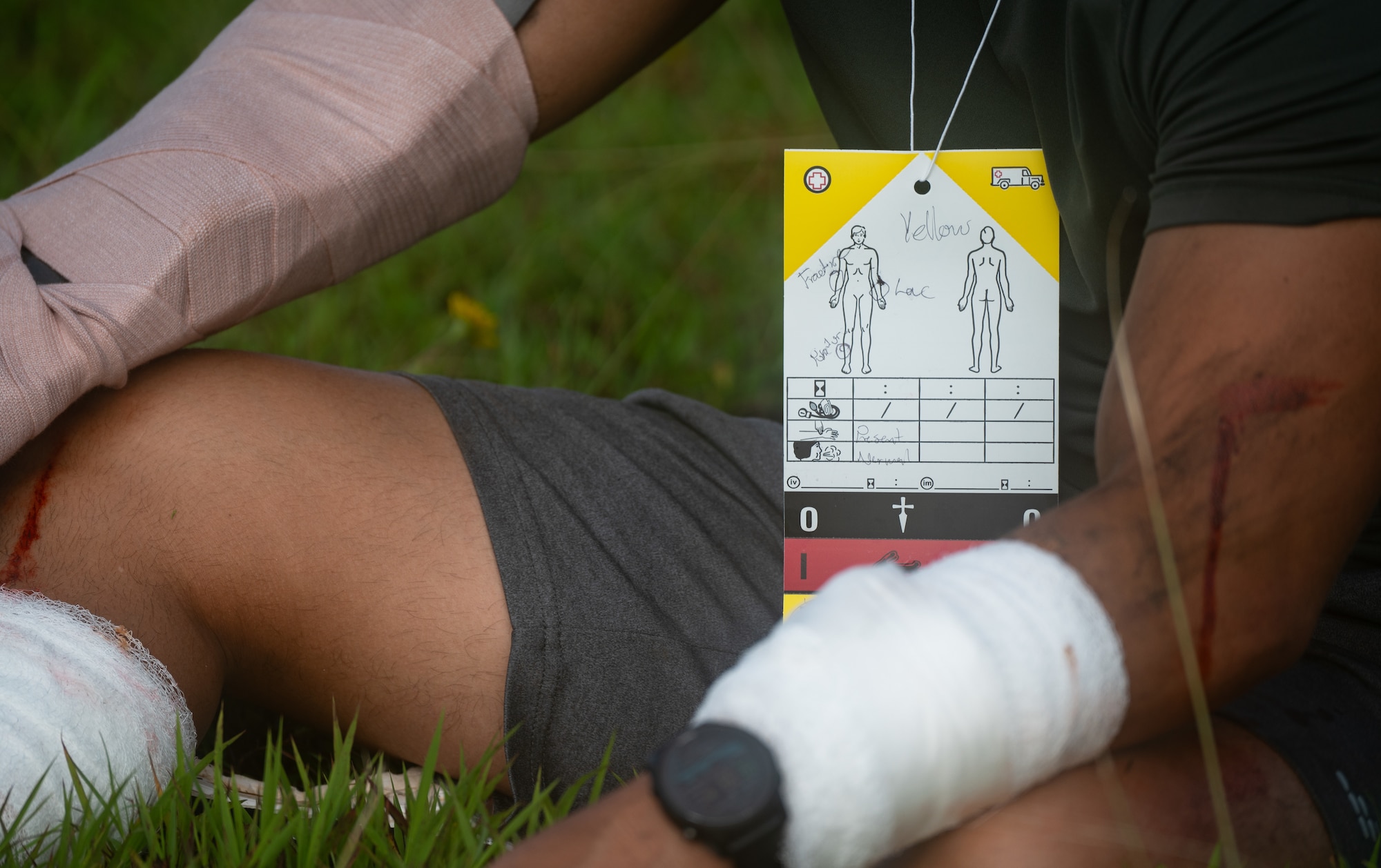 Injuries of a simulated injured Airman are written on a hanging card during a major accident response exercise (MARE) for Slingstone 24-4 at Andersen Air Force Base, Guam, Oct. 22, 2024. The MARE allows first responders to hone the skills needed should a real accident happen. This scenario included a simulated plane fire and passengers scattered around with various injuries. (U.S. Air Force photo by Staff Sgt. Pedro Tenorio)