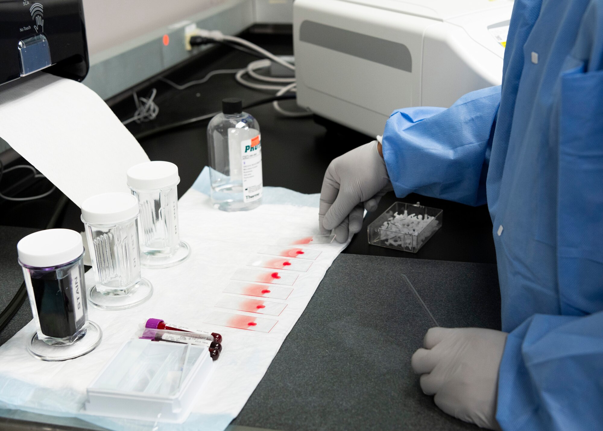 Medical technician creates blood smears on slides.
