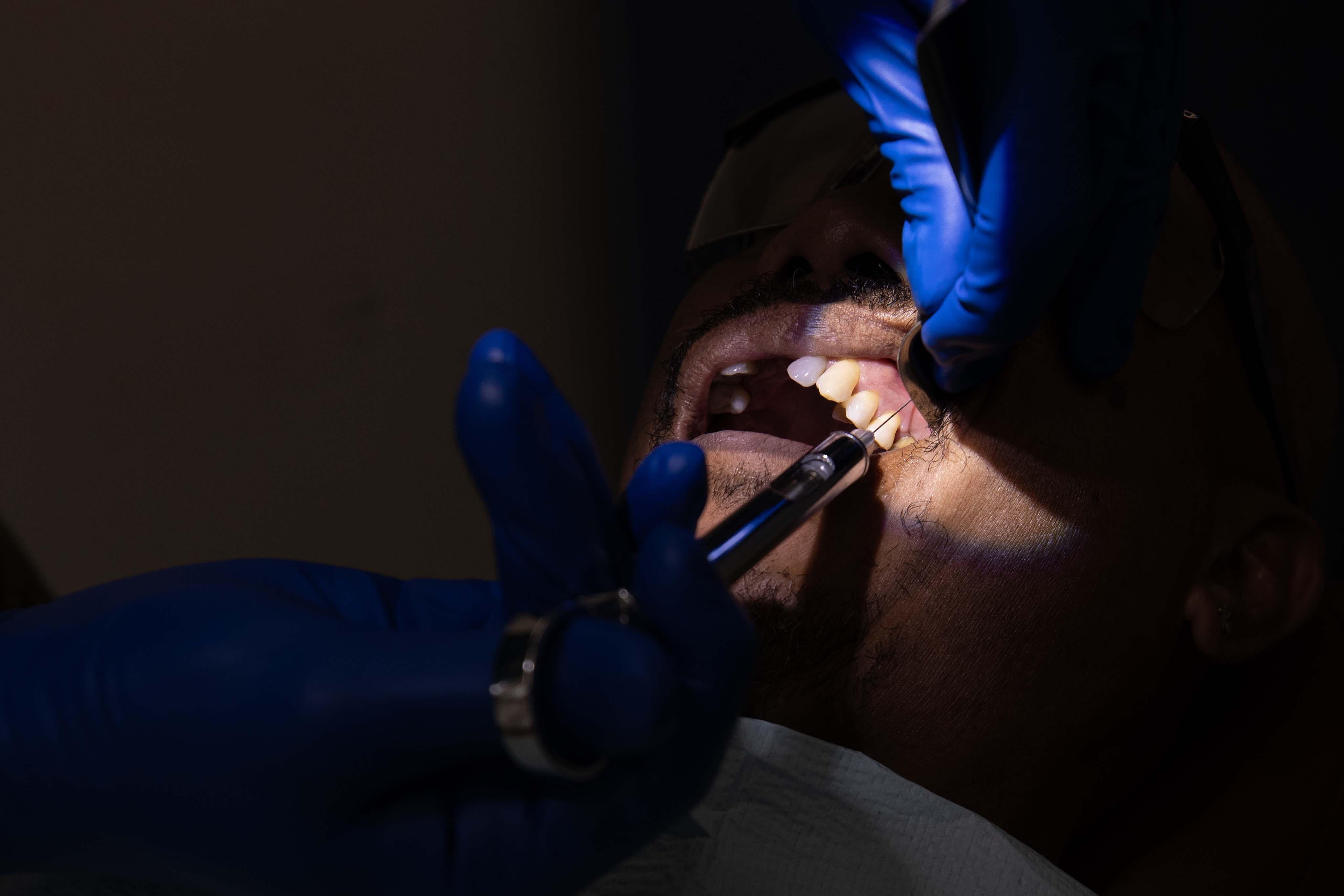 YAP, Federated States of Micronesia (Sept. 9, 2024) – Canadian Armed Forces Maj. Dominik Rudecki, a Canadian Army Oral and Maxillofacial Surgeon in the Royal Canadian Dental Corps, injects local anesthesia into the gumline of a patient during an oral surgery at Yap State Hospital in support of the Pacific Partnership 2024-2 medical line of effort in Yap, Federated States of Micronesia, Sept. 9, 2024. Now in its 20th iteration, the Pacific Partnership series is the U.S. Navy’s largest annual multinational humanitarian assistance and disaster relief preparedness mission conducted in the Indo-Pacific. Pacific Partnership works collaboratively with host and partner nations to enhance regional interoperability and disaster response capabilities, increase security and stability in the region, and foster new and enduring friendships in the Indo-Pacific. (U.S. Navy photo by Mass Communication Specialist 1st Class Ryan D. McLearnon/Released)