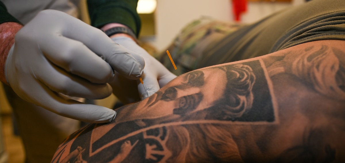 Gregory Norris, 42nd Medical Group physical medicine technician, inserts a dry needle into the shoulder of U.S. Air Force Senior Airman Christopher Neal, 42nd Medical Group physical medicine technician, at Maxwell Air Force Base, Alabama, April 8, 2025.