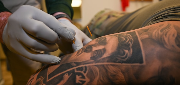 Gregory Norris, 42nd Medical Group physical medicine technician, inserts a dry needle into the shoulder of U.S. Air Force Senior Airman Christopher Neal, 42nd Medical Group physical medicine technician, at Maxwell Air Force Base, Alabama, April 8, 2025.