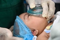 U.S. Air Force members from the Lesser Antilles Medical Assistant Team and Georgetown Public Hospital healthcare professionals at the Georgetown Public Hospital administer general anesthesia on a two-month-old patient before receiving eye surgery in Georgetown, Guyana, April 7, 2025.