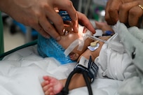 U.S. Air Force Maj. Samuel Hobbs, 59th Medical Wing vitreoretinal surgeon, and Georgetown Public Hospital healthcare professionals at the Georgetown Public Hospital examine a two-month-old patient under anesthesia before receiving eye surgery in Georgetown, Guyana, April 7, 2025.