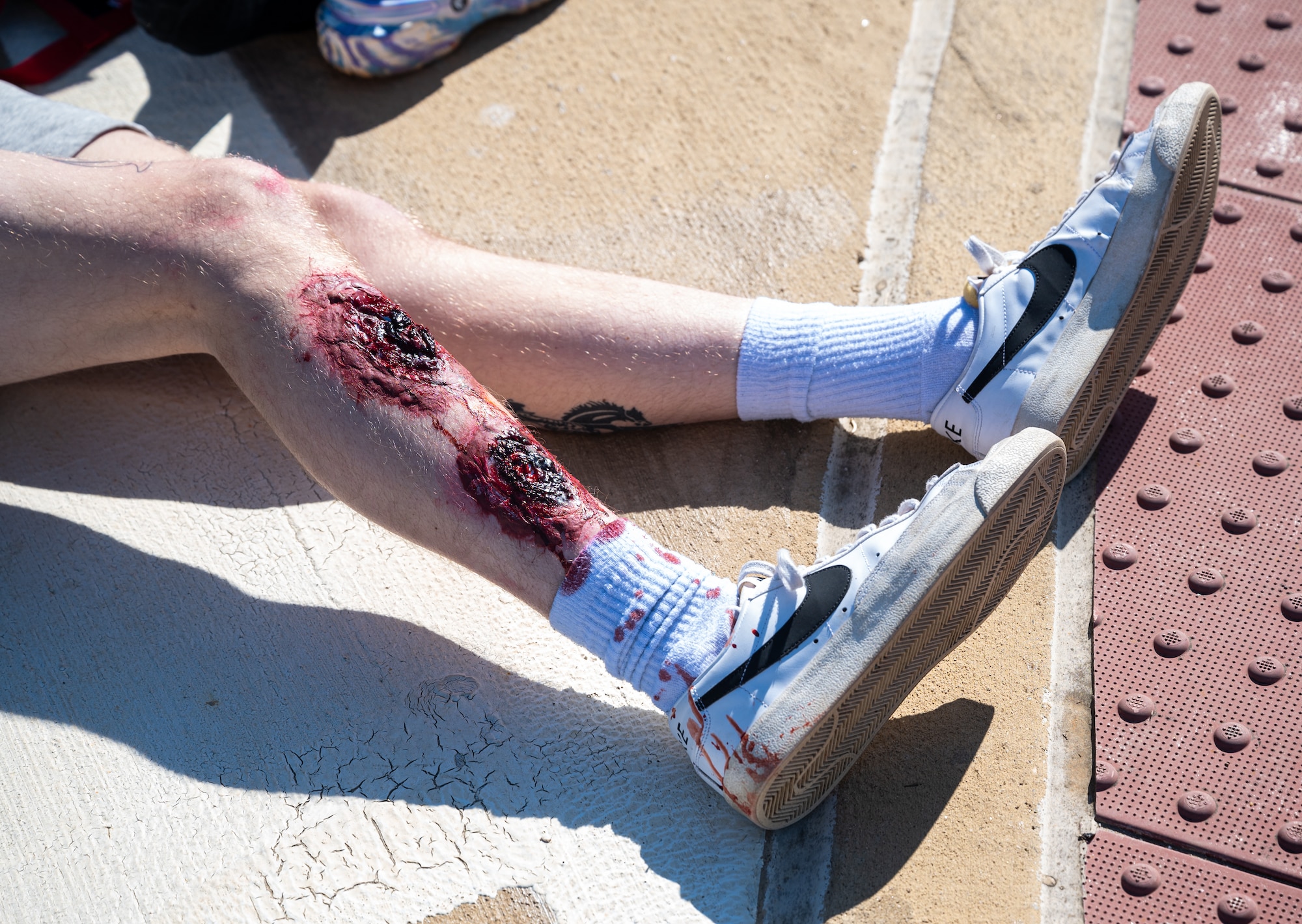 A close up of an injured leg.