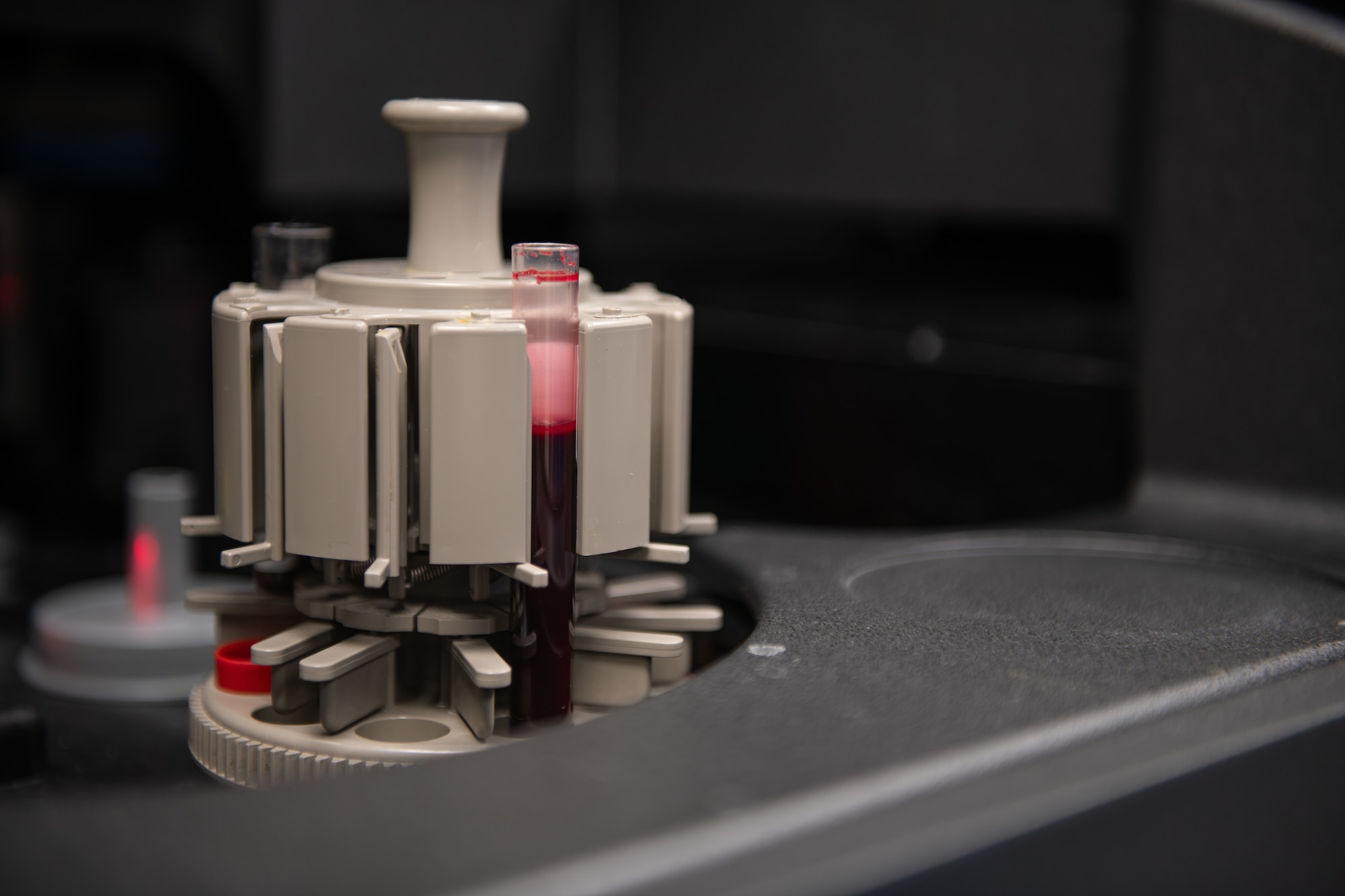 A blood sample vial is displayed in a gray chemistry analyzer.