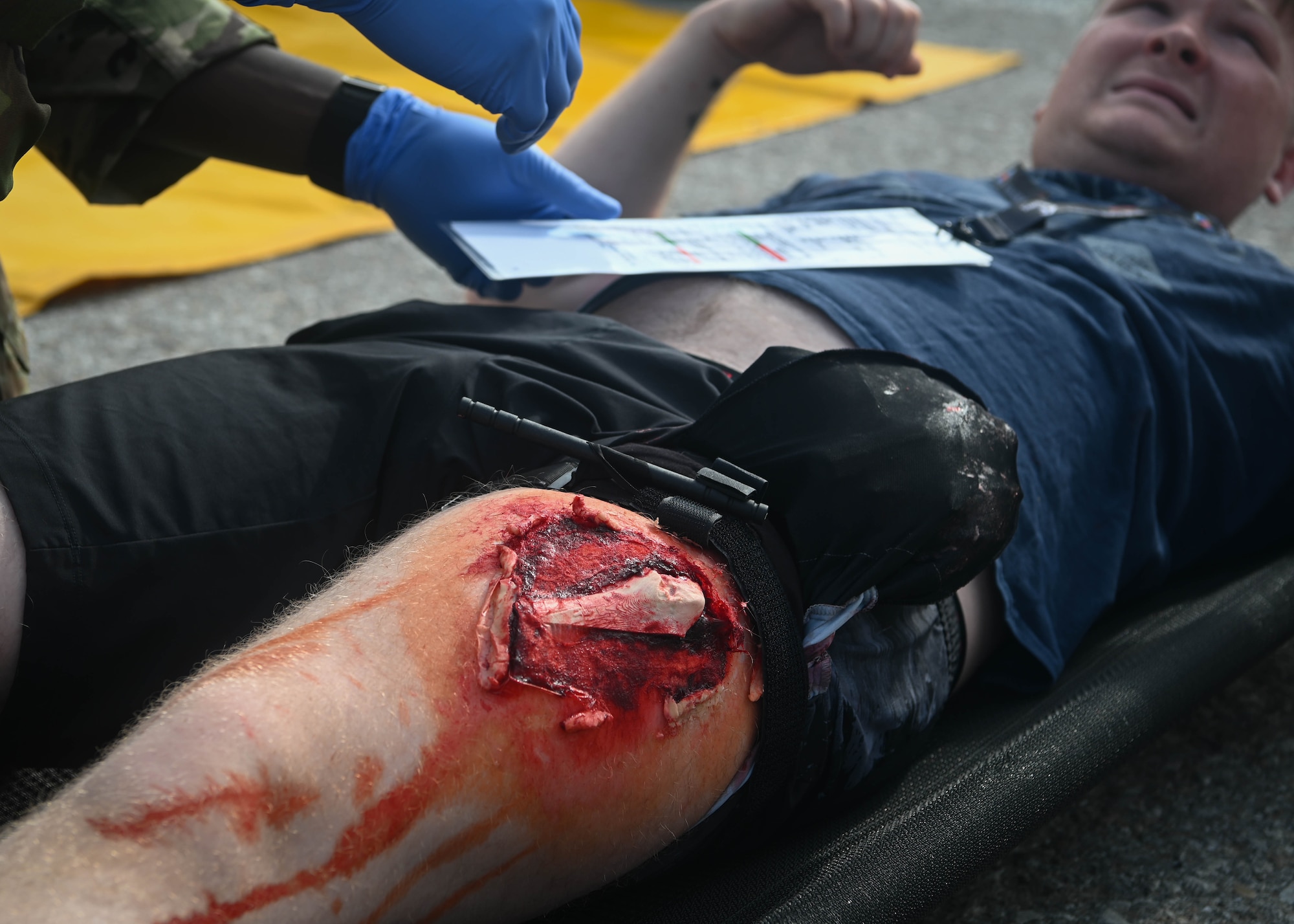 A 55th Medical Group Airman tends to a simulated leg injury on Airman 1st Class Cameron McGurk, 55th Logistics Readiness Squadron liquid fuels distribution operator, during a Major Accident Response Exercise on Offutt Air Force Base, Nebraska, July 30, 2025. A MARE is an exercise held annually to test and evaluate the emergency response to a major accident. (U.S. Air Force photo by Daniel Martinez)