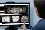 Medical professional looks at dental x-rays