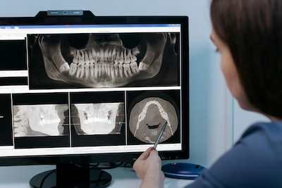 Medical professional looks at dental x-rays