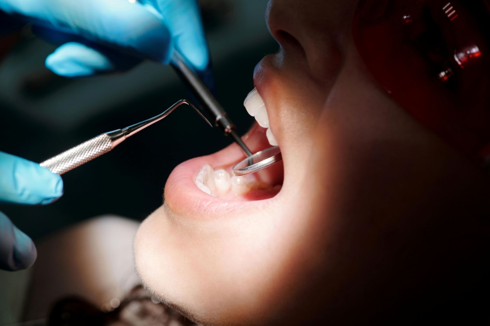 Dentist uses a dental pick and a mirror to examine a patient's teeth.