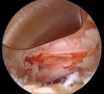 251217-N-TW242-1006 Okinawa, Japan Dr. Lawless performing the procedure in the USNHO OR under the high powered laparoscope. (U.S. Navy photo courtesy asset)