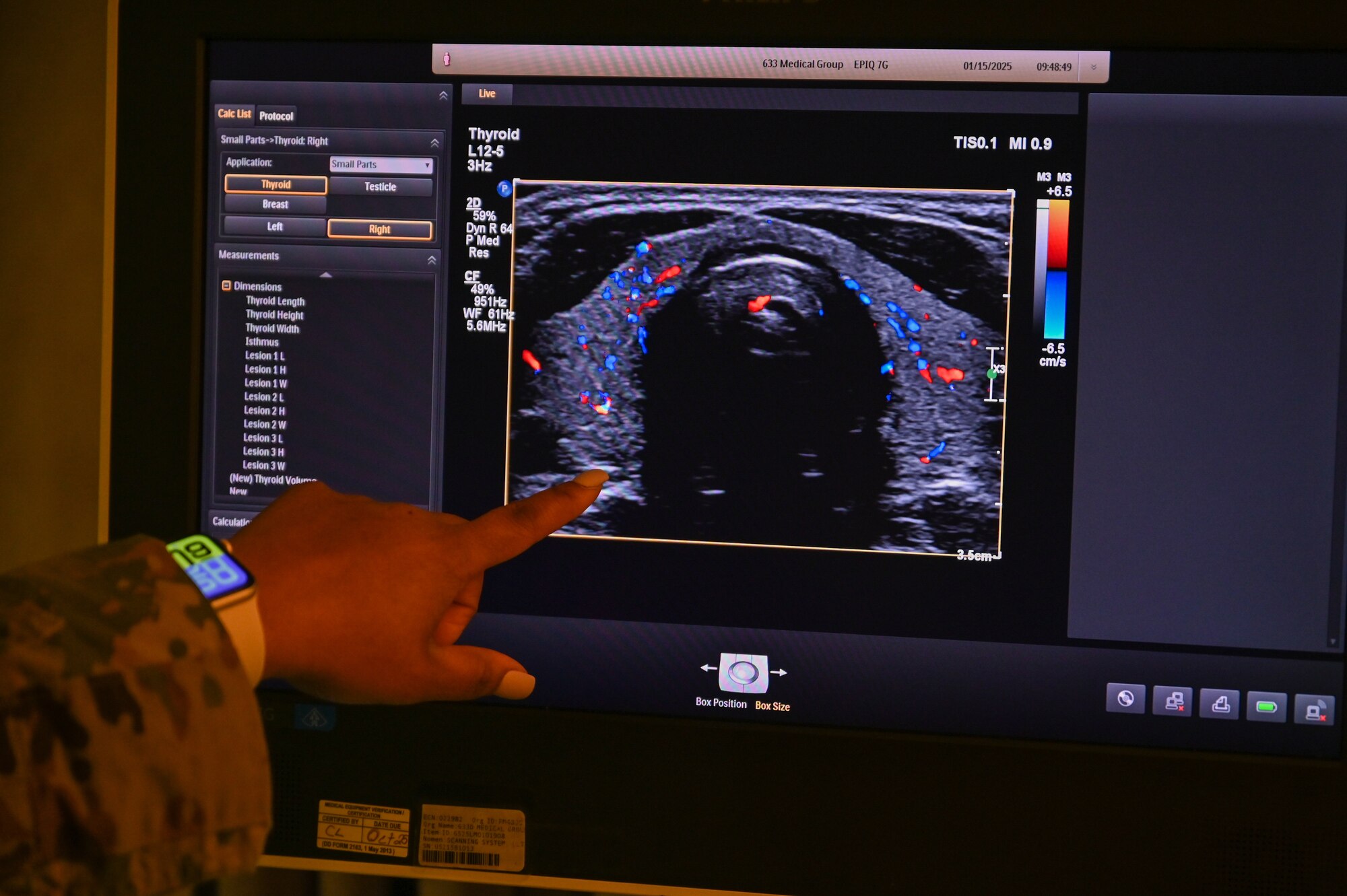 Woman pointing at an ultrasound image on the ultrasound machine.