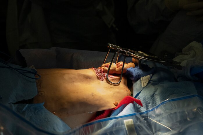 A U.S. Marine with 31st Marine Expeditionary Unit, acts as a simulated casualty during a medical drill aboard the amphibious assault ship USS America (LHA 6), in the Philippine Sea, Feb. 1, 2025.The drill was conducted to evaluate corpsmen and ship surgeons’ response-and-triage tactics while providing medical care in a variety of simulated scenarios while underway. The America Amphibious Ready Group (ARG), compromising amphibious assault carrier USS America (LHA 6), amphibious transport dock ship USS San Diego (LPD 22), and amphibious dock landing ship USS Rushmore (LSD 47) along with the 31st Marine Expeditionary Unit (MEU), are underway conducting routine integrated operations in U.S. 7th Fleet area of operations. U.S. 7th Fleet is the U.S. Navy’s largest forward-deployed numbered fleet and routinely interacts and operators with allies and partners to preserve a free and open Indo-Pacific region. (U.S. Marine Corps photo by Pfc. Skilah Sanchez)