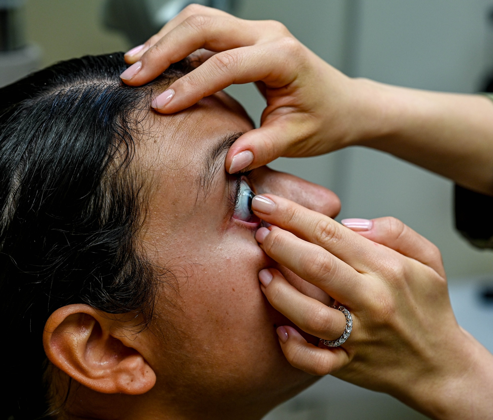 A woman's hands placing a contact lens into a patient's eye.
