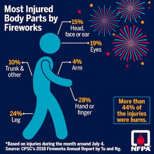 Fireworks: Leave it to the experts!