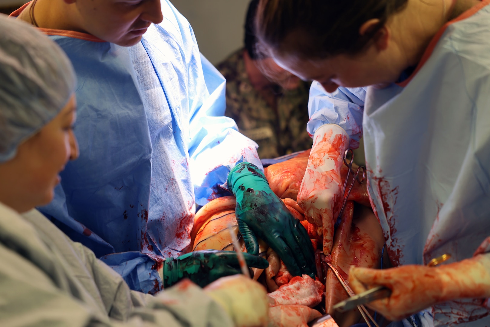 A surgical team with Expeditionary Medical Facility (EMF) 150-Alpha performs a surgery on a simulated patient wearing a surgical “cut suite” to mimic the look, feel and smell of severe trauma injuries, allowing the team to safely practice real procedures. The use of surgical simulators like the “cut suit” adds realism to the EMF training and Operational Readiness Evaluation (ORE) facilitated by the Naval Expeditionary Medicine Warfighter Development Center (NEMWDC), Camp Pendleton, Calif., Feb. 15-28.