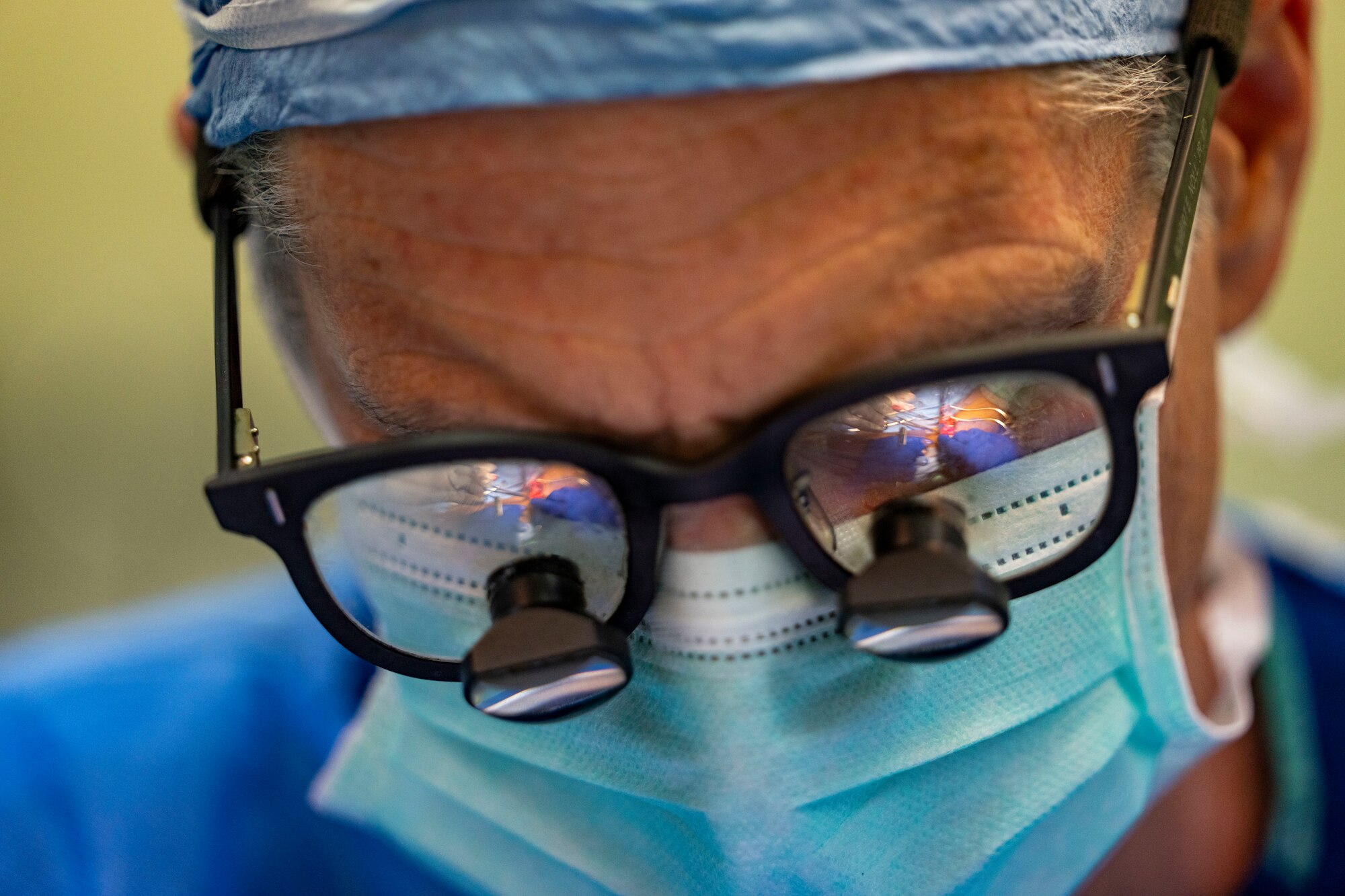 U.S. Air Force Col. Robert Knoll, 349th Medical Squadron commander and vascular surgeon, conducts a Arteriovenous Fistula procedure on a patient during the Lesser Antilles Medical Assistance Team mission at St. Jude Hospital in Vieux Fort, Saint Lucia, March 4, 2025. Knoll, a vascular surgeon, is addressing a critical shortage of specialized care by performing life-saving vascular surgery in St. Lucia, simultaneously honing essential skills for future U.S. military deployments. The LAMAT mission seeks to strengthen U.S. partnerships within Latin America and the Caribbean region by providing relief to overwhelmed medical facilities through collaboration with host nation medical practitioners and respective Ministry of Health officials.  (U.S. Air Force photo by Andrea Jenkins)