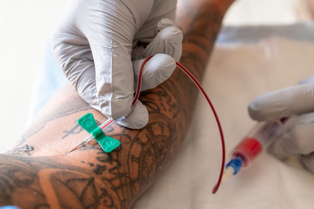 A blood sample is collected via a winged infusion set from a patient's arm.